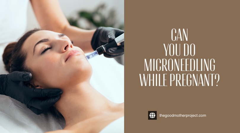 can you do microneedling while pregnant